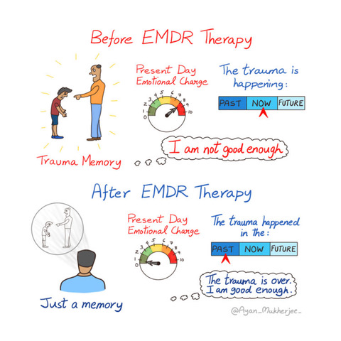 Explain EMDR Therapy